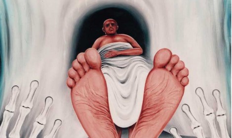 Jack Kevorkian, Coma, 1996 (detail)