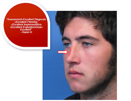 Opening Reception: Nose Job
