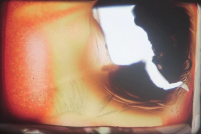 Vitreous Chamber: Malic Amalya & Nathan Hill